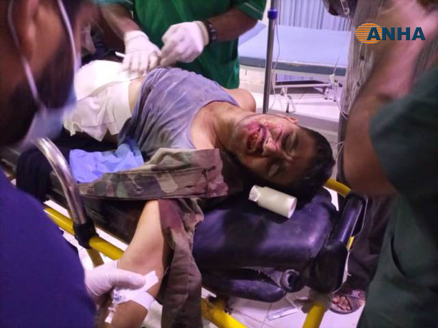 Saldırıda bir Şam Hükümeti askeri yaralandı