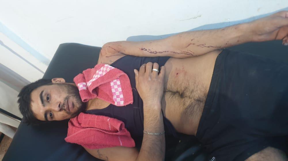 Girê Spî’deki bombardımanda iki Şam hükümeti askeri yaralandı - YENİLENDİ