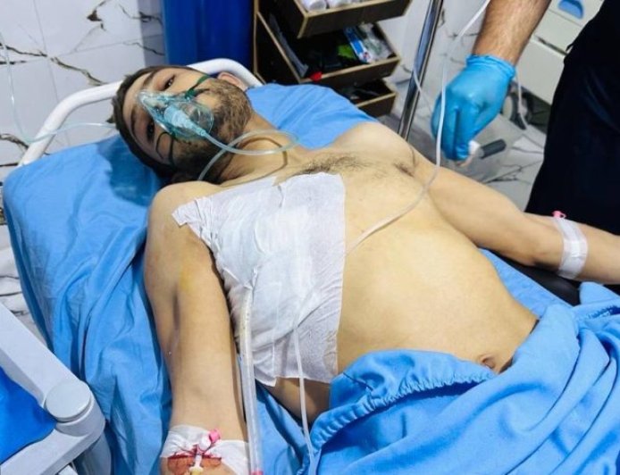 İşgalci Türk devleti Kobanê’de tarlasını sulayan bir yurttaşı bombaladı